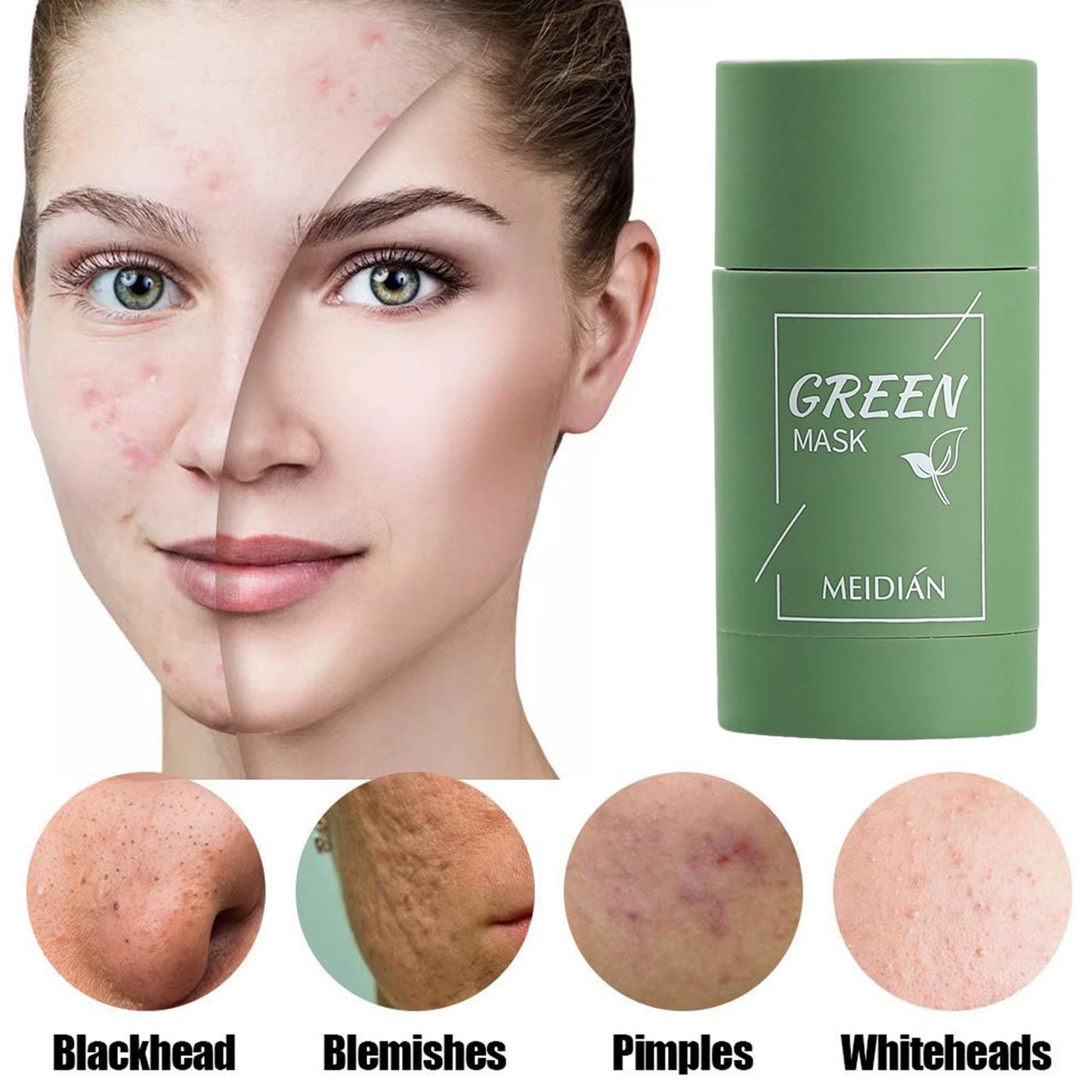 Green Tea Cleansing Mask for Acne and Blemish Treatment - Natural Plant-Based Formula for Blackhead Removal and Gentle Skincare Solutions