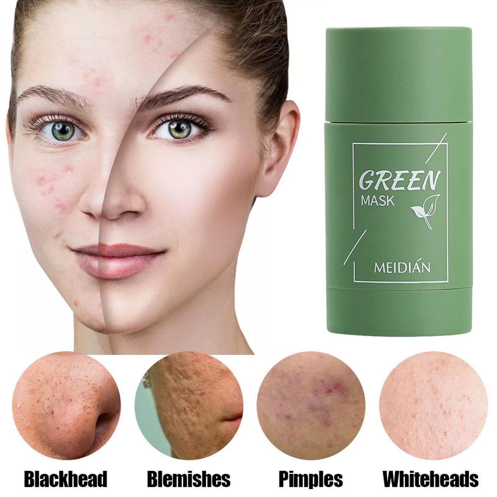 Green Tea Cleansing Mask for Acne and Blemish Treatment - Natural Plant-Based Formula for Blackhead Removal and Gentle Skincare Solutions