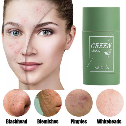 Green Tea Cleansing Mask for Acne and Blemish Treatment - Natural Plant-Based Formula for Blackhead Removal and Gentle Skincare Solutions